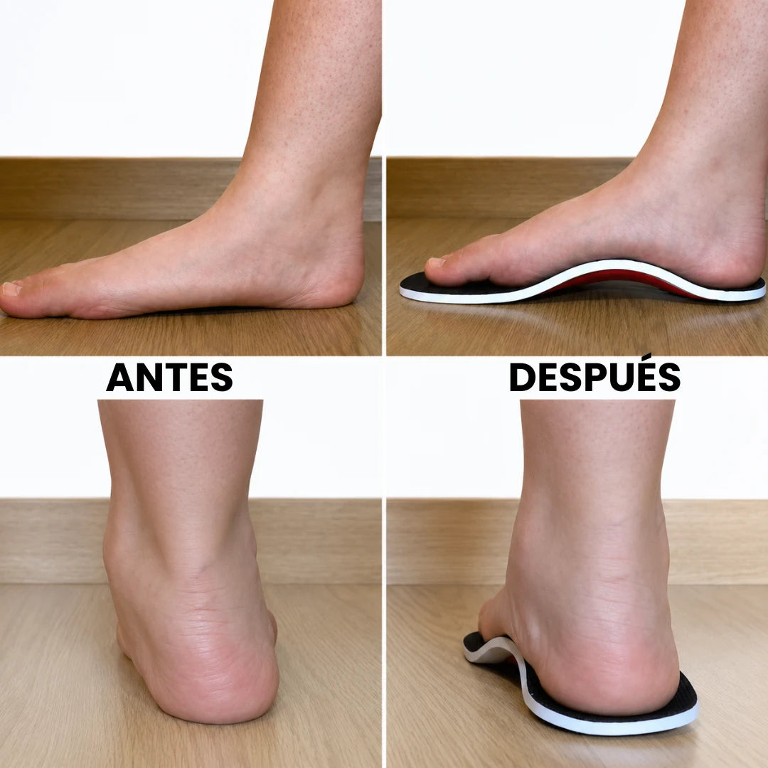 TeraPlantillas™ - Plantillas con soporte para el arco