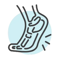 Fascitis Plantar